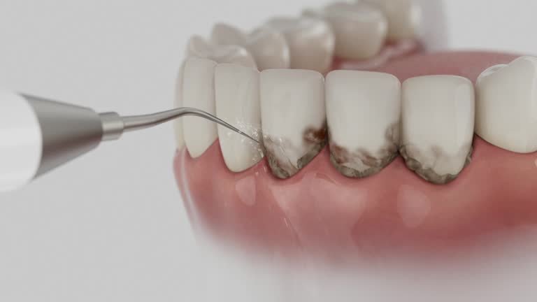 Reliable Dental contractor in Calhoun, GA by Dentist Open Now